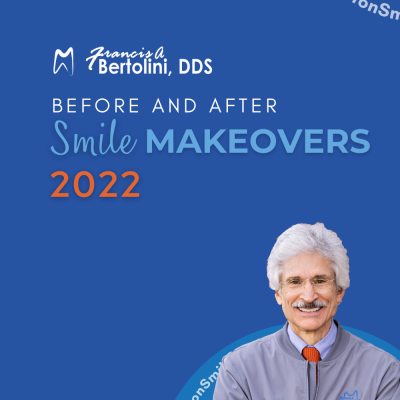Francis A. Bertolini, DDS: Best of Smile Makeovers: 2022 Edition
