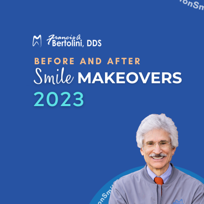 Francis A. Bertolini, DDS: Best of Smile Makeovers 2023 Edition