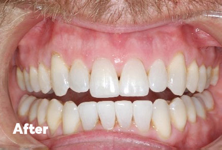 orthodontics and whitening